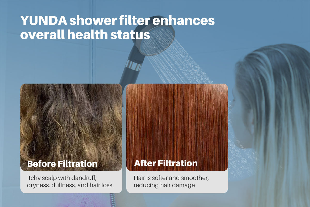 YUNDA High-pressure Filtered Shower Head